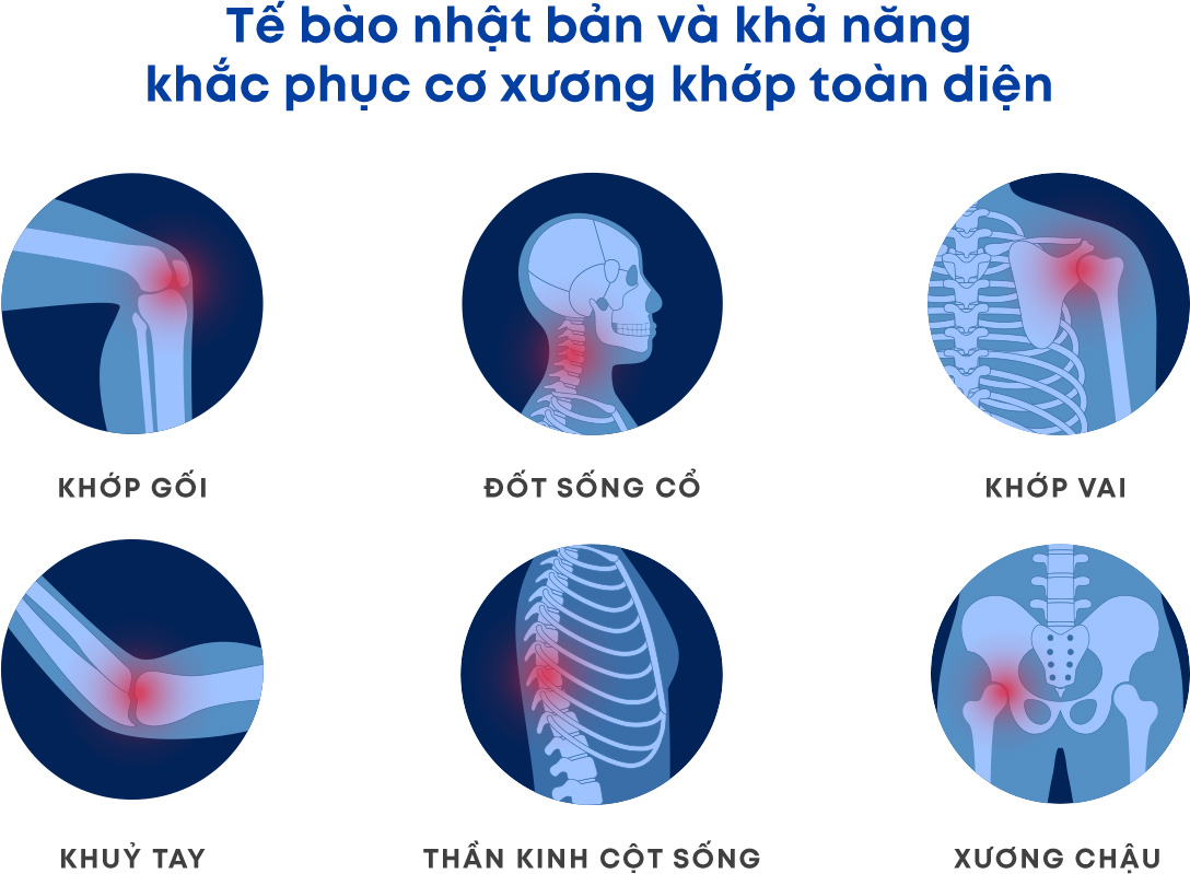 Điều Trị Cơ Xương Khớp Thông Minh